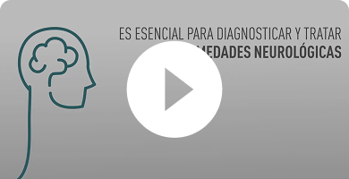 division-de-neuro-oncologia-coi-thumb-faqs-3